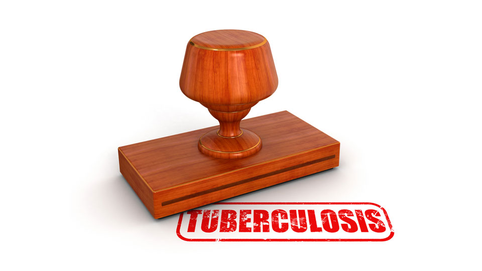 UK Settlement Visa Tuberculosis Test